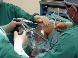 Knee replacement in Iran